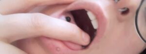 Cyra